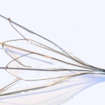 Get An Advance  IVC Filter Lawsuits: Money Before Case Even Settles